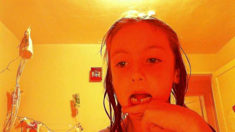My tooth is gone!